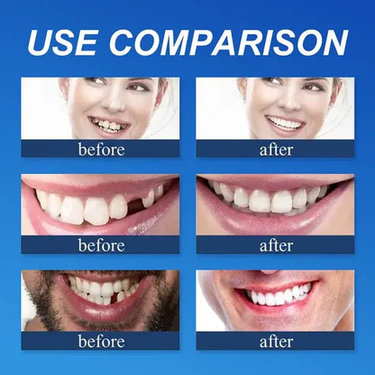 🌎Ends Today: 49% OFF!⏰KLENIMORE™ Custom-Fit Smile Support Kit — Strong Suction Feel & Natural-Looking Fit